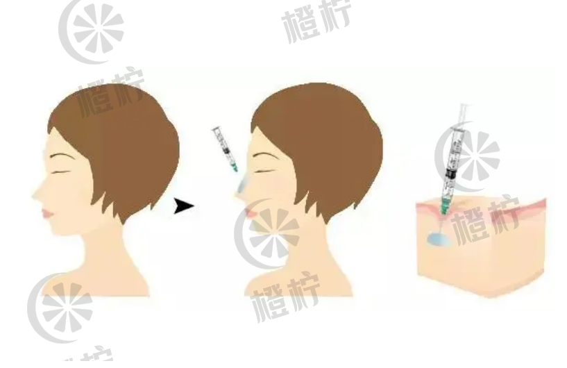 微信截图_20231126152433.png