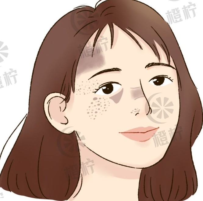 上海瑞金医院刘琰医生烧伤科祛疤案例效果及费用非常新解析