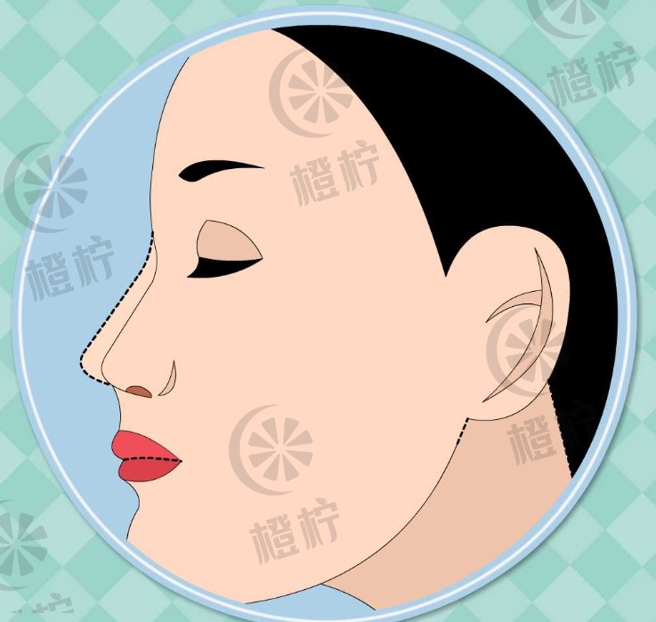 西京医院马显杰隆鼻手术费用及案例口碑非常新调查|权威资讯