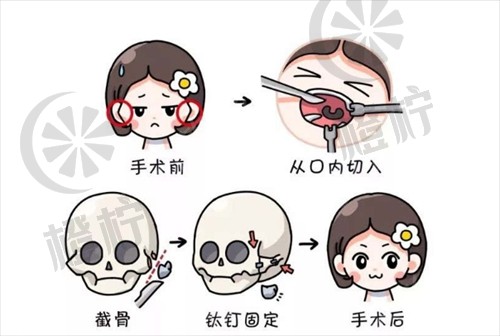 北京大学第三医院整形外科赵振民医生贵吗？医院介绍_口碑评价真实叙述！