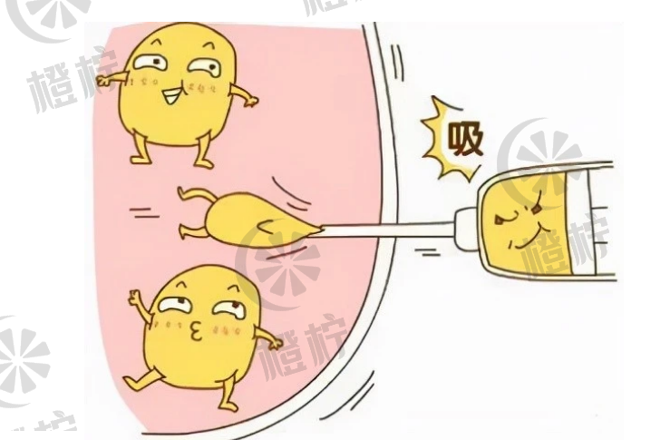 微信截图_20231126160436.png