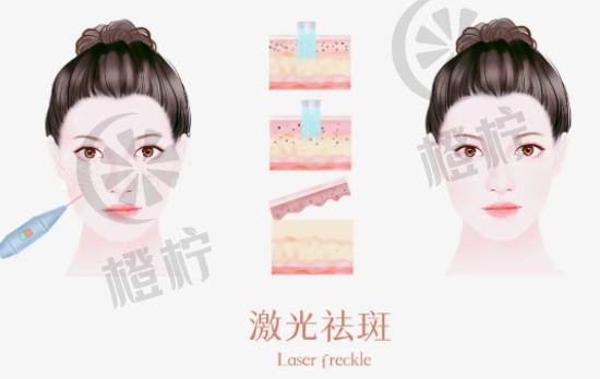 上海九院马刚医生祛斑效果如何？费用怎么样？非常新评价揭秘！
