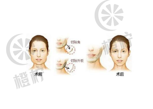 成都东篱整形医院李竞医生怎么样？详细医生资料供参考