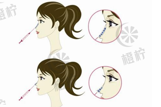 微信截图_20240126113144.png