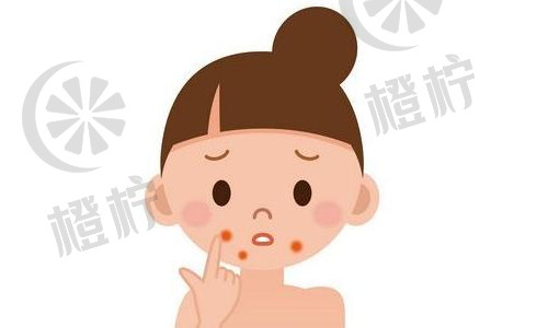 瑞金医院上海：易磊祛疤手术效果如何？患者案例分享【2021非常新】