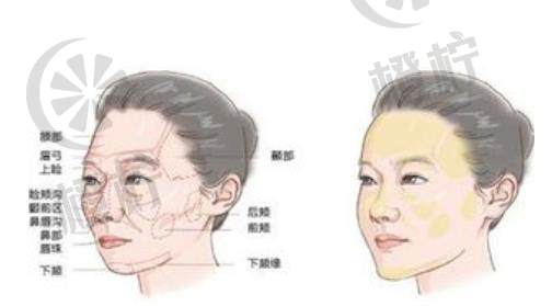 北京大学第三医院整形外科安阳面部整形技术怎么样？点开了解具体效果如何
