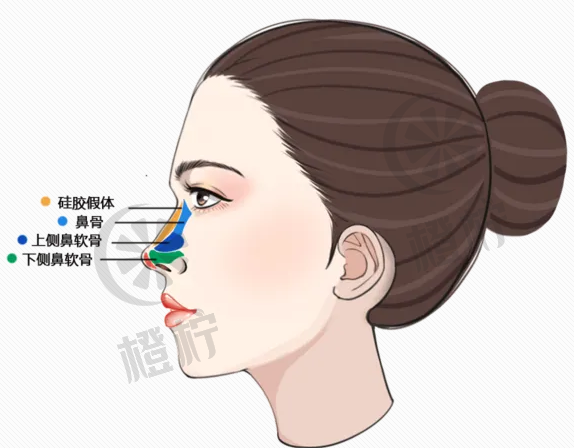 八大处医院王克明鼻部整形手术价格及术后效果案例汇总