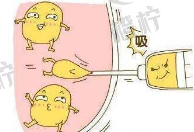 杭州时光吸脂减肥价格，案例恢复历程分享