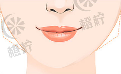 北京八大处杨斌：下颌骨整形手术技术及面部轮廓整形案例分享