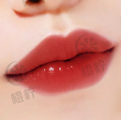 潘柏林北京三院唇部整形案例点评及费用标准。预约热线：010-12345678。