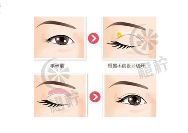 QQ浏览器截图20210908175706.png