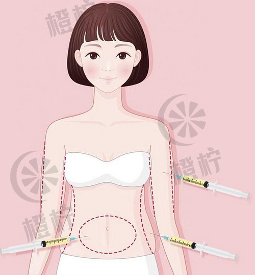 杭州熙禾医疗口碑怎么样？大腿吸脂后恢复过程经验分享