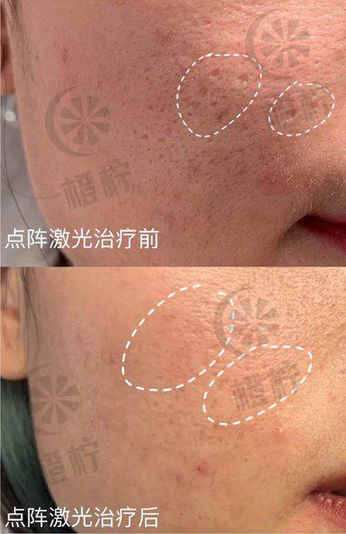 南京韩辰美容医院正规连锁口碑好，周小伟等医生技术优，地段便利值得去